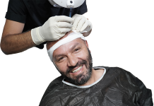 How to Secure the Best Hair Transplant in Antalya: A Comprehensive Guide How to Secure the Best Hair Transplant in Antalya: A Comprehensive Guide